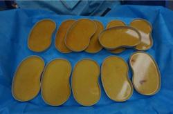 “英捷尔法勒注射隆胸：20年后单侧乳房异常肿大引发关注”