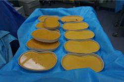 奥美定取出后可能遇到的症状及相关并发症解析