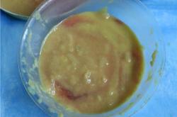 济宁地区奥美定取出手术：风险、费用及必要性解析