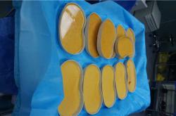 奥美定取出后胸部恢复及再度增大的可能性与风险