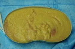 奥美定取出哪家医院好？专业解析费用及危害