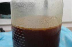 奥美定取出后自体脂肪填充的风险与费用分析