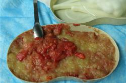 奥美定取出费用是否包含检查费用详细解析