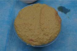 北京与广州奥美定取出手术对比：哪个城市更适合？