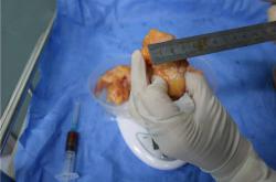 深入了解：丰体针丰胸可能带来的健康危害