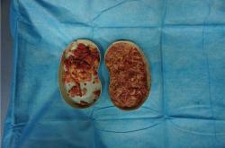 北京奥美定取出指定医院：安全与专业结合的引领者