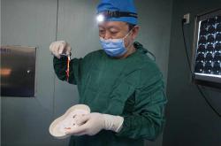 奥美定取出术后一年：恢复历程与经验分享