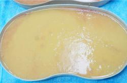 探讨英捷尔法勒凝胶隆胸20年不取的潜在风险与效果。