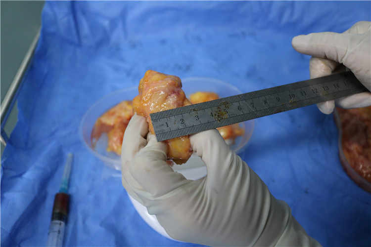 “揭秘奥美定取出后的真实颜色与健康隐患”