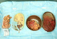 奥美定的危害有哪些